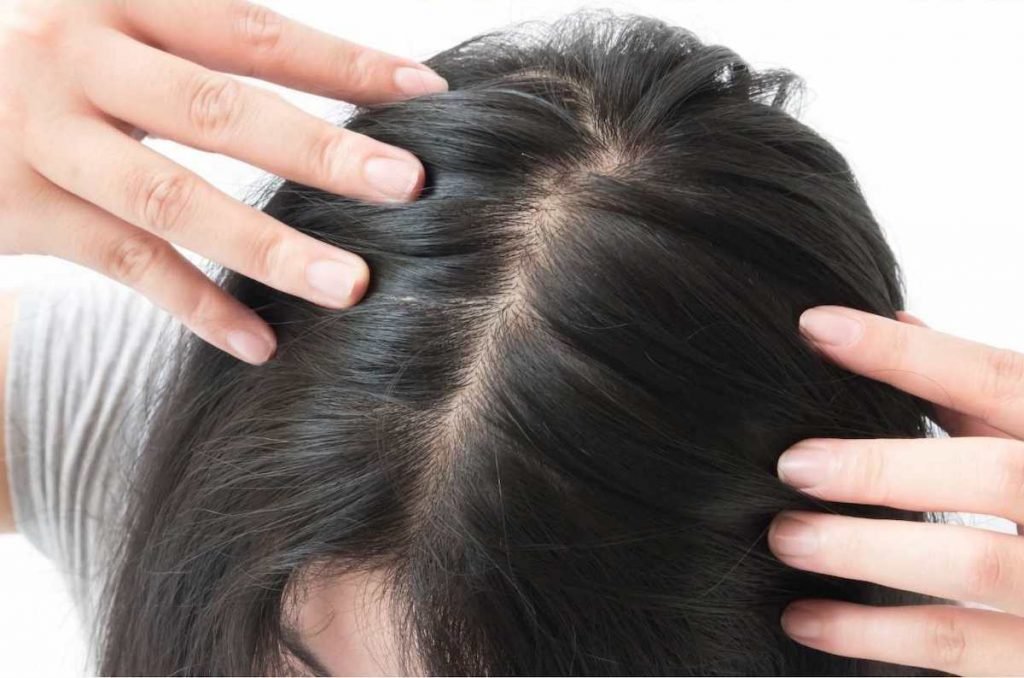 Matcha may help you grow hair – Enjoy Green Tea